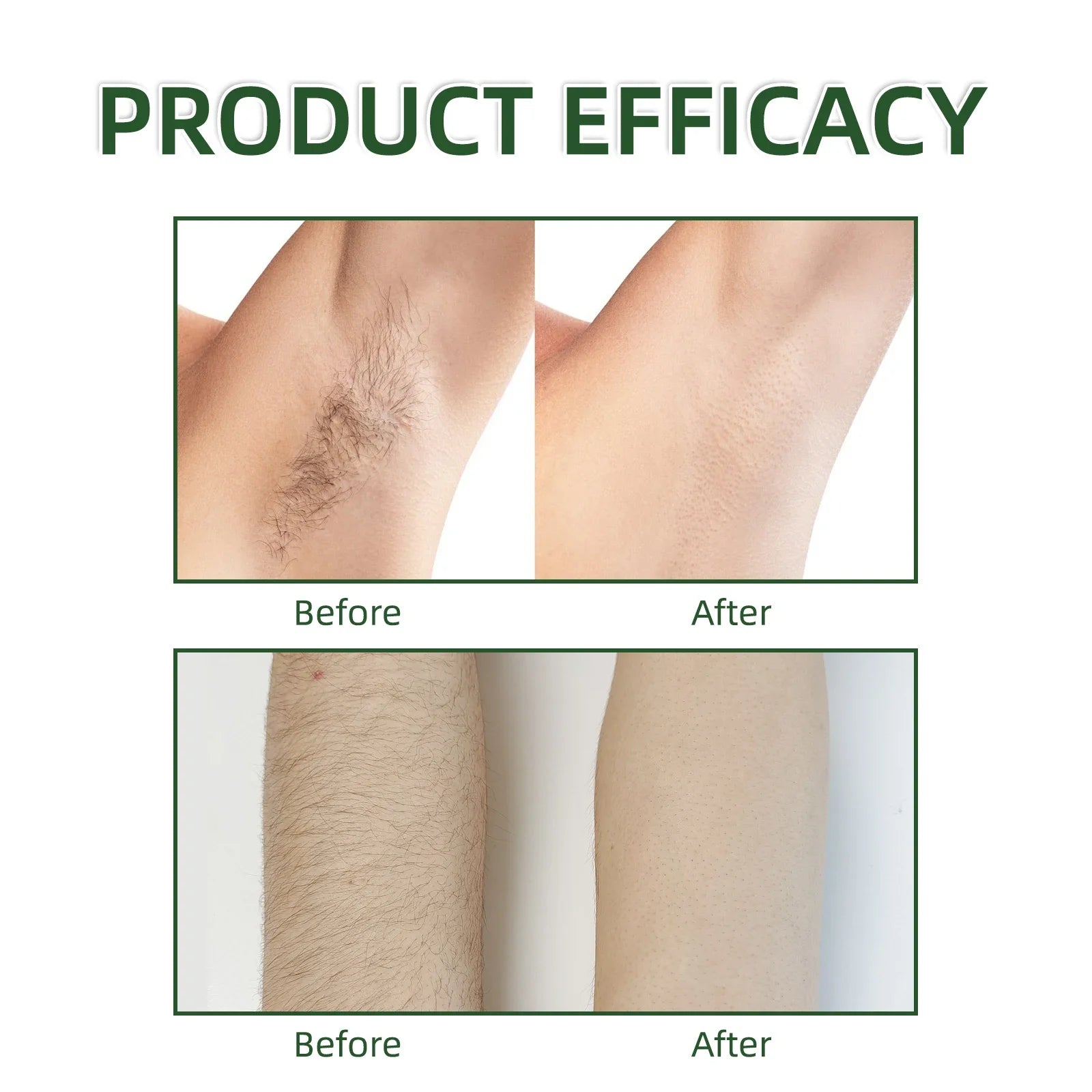 Hair Removal Oil – 60ml , 
Smooth. Calm. Hydrated.
Post-depilation oil with Echinacea to reduce pores, moisturize deeply, and soothe sensitive skin for a flawless finish 🌿